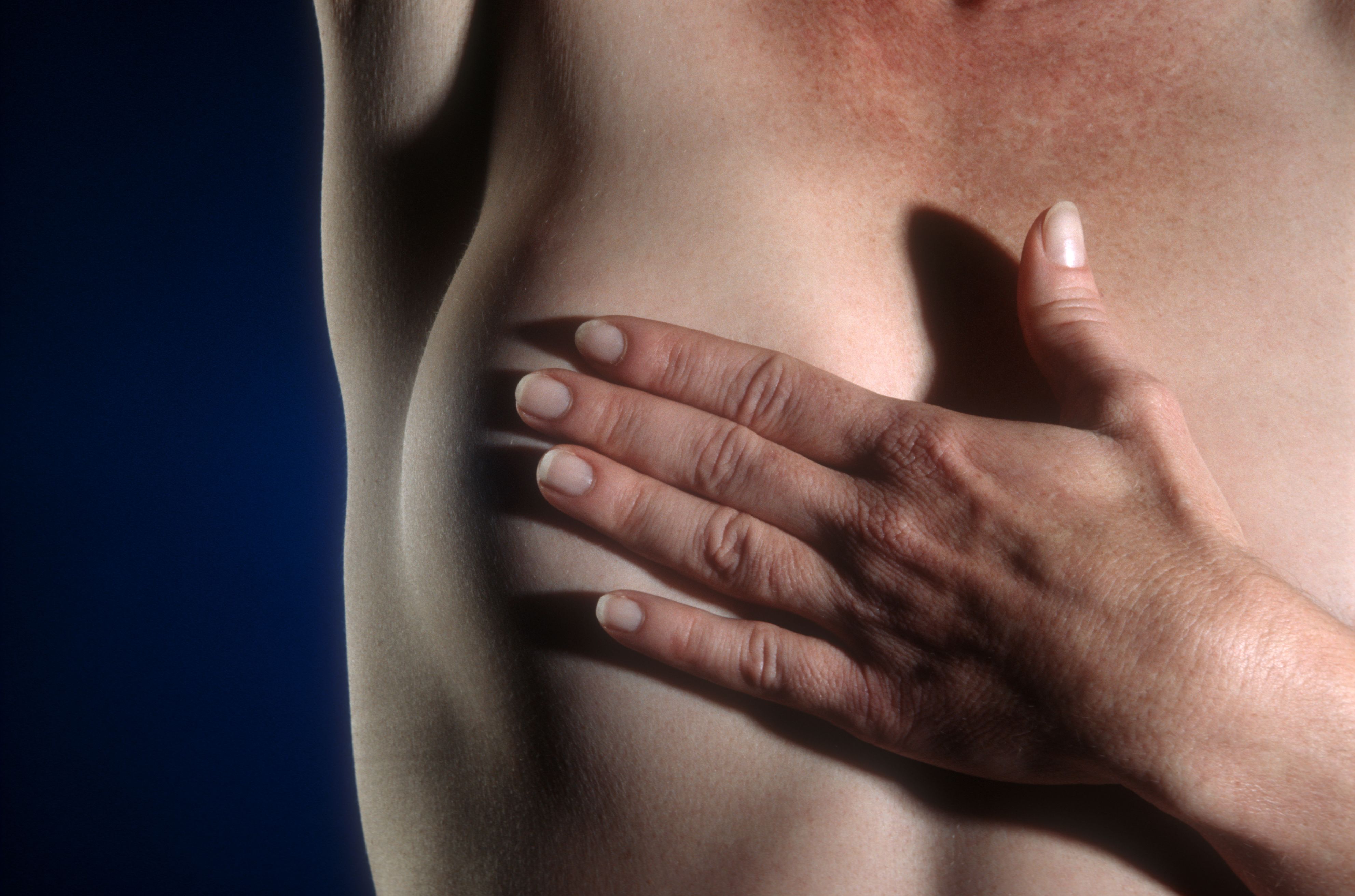Patient undergoing a breast reconstruction consultation.